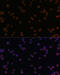 Chitinase 3 Like 1 antibody, GTX55570, GeneTex, Immunocytochemistry image 