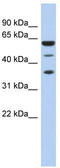 Negative Elongation Factor Complex Member E antibody, TA345818, Origene, Western Blot image 