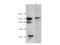 Histone Deacetylase 7 antibody, A01913, Boster Biological Technology, Western Blot image 