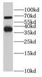 Lactase Like antibody, FNab04732, FineTest, Western Blot image 