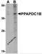 Phospholipid Phosphatase 5 antibody, 5515, ProSci, Western Blot image 