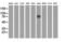 EPM2A Interacting Protein 1 antibody, GTX84564, GeneTex, Western Blot image 