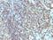 MHC II HLA-DR beta antibody, NBP2-48122, Novus Biologicals, Immunohistochemistry paraffin image 