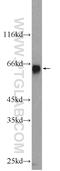 Zinc Finger Imprinted 3 antibody, 25200-1-AP, Proteintech Group, Western Blot image 