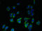 Endoplasmic Reticulum-Golgi Intermediate Compartment 1 antibody, orb351313, Biorbyt, Immunocytochemistry image 