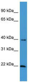 Estrogen Receptor Binding Site Associated Antigen 9 antibody, TA342763, Origene, Western Blot image 