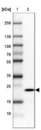 Ribonuclease P protein subunit p25 antibody, NBP1-92349, Novus Biologicals, Western Blot image 