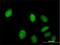 Zinc Finger C2HC-Type Containing 1A antibody, H00051101-B01P, Novus Biologicals, Immunofluorescence image 