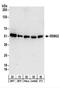 RNA Binding Motif Protein 22 antibody, NBP2-22275, Novus Biologicals, Western Blot image 