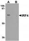 Interferon regulatory factor 4 antibody, TA319669, Origene, Western Blot image 