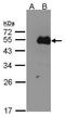 Nuclear Factor I B antibody, PA5-28299, Invitrogen Antibodies, Western Blot image 