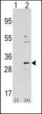 Nicotinamide N-Methyltransferase antibody, TA302022, Origene, Western Blot image 