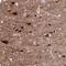 Homer Scaffold Protein 1 antibody, NBP2-38308, Novus Biologicals, Immunohistochemistry frozen image 