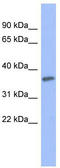 Protein Kinase C Gamma antibody, TA342149, Origene, Western Blot image 