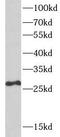 Sepiapterin Reductase antibody, FNab08192, FineTest, Western Blot image 
