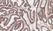 Acyl-CoA Dehydrogenase Medium Chain antibody, NBP1-31397, Novus Biologicals, Immunohistochemistry paraffin image 