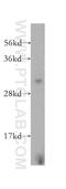 COP9 Signalosome Subunit 7A antibody, 16628-1-AP, Proteintech Group, Western Blot image 