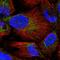 E3 ubiquitin-protein ligase MARCH5 antibody, HPA056596, Atlas Antibodies, Immunocytochemistry image 