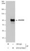 HMMR antibody, GTX121502, GeneTex, Immunoprecipitation image 