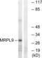 Mitochondrial Ribosomal Protein L9 antibody, LS-C119637, Lifespan Biosciences, Western Blot image 