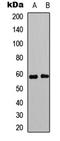 Estrogen Receptor 2 antibody, LS-C358984, Lifespan Biosciences, Western Blot image 