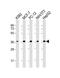 Eukaryotic translation initiation factor 2 subunit 1 antibody, M04387-2, Boster Biological Technology, Western Blot image 