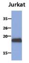 MAF BZIP Transcription Factor K antibody, GTX53738, GeneTex, Western Blot image 