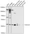 Succinate-CoA Ligase ADP-Forming Beta Subunit antibody, GTX64854, GeneTex, Western Blot image 