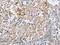 Centromere Protein E antibody, CSB-PA722114, Cusabio, Immunohistochemistry paraffin image 
