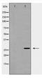 Caveolin 2 antibody, TA348013, Origene, Western Blot image 