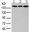 BCR Activator Of RhoGEF And GTPase antibody, TA322768, Origene, Western Blot image 