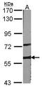 A-Raf Proto-Oncogene, Serine/Threonine Kinase antibody, GTX101427, GeneTex, Western Blot image 