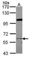 Karyopherin Subunit Alpha 3 antibody, GTX114511, GeneTex, Western Blot image 