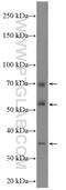 Adaptor Related Protein Complex 5 Subunit Mu 1 antibody, 26567-1-AP, Proteintech Group, Western Blot image 