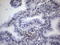 Tumor Protein P53 Binding Protein 1 antibody, LS-C791148, Lifespan Biosciences, Immunohistochemistry paraffin image 
