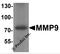 Matrix metalloproteinase-9 antibody, 7471, ProSci Inc, Western Blot image 