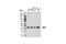 BMI1 Proto-Oncogene, Polycomb Ring Finger antibody, 5856S, Cell Signaling Technology, Western Blot image 