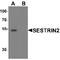 Sestrin-2 antibody, TA349117, Origene, Western Blot image 