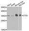 CTSV antibody, A7662, ABclonal Technology, Western Blot image 
