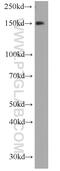 Erythrocyte Membrane Protein Band 4.1 Like 2 antibody, 15437-1-AP, Proteintech Group, Western Blot image 