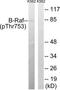 Serine/threonine-protein kinase B-raf antibody, TA326041, Origene, Western Blot image 