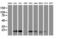 Migration And Invasion Enhancer 1 antibody, M07379, Boster Biological Technology, Western Blot image 