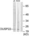 Dual Specificity Phosphatase 22 antibody, LS-C119279, Lifespan Biosciences, Western Blot image 