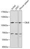 Cbl Proto-Oncogene B antibody, GTX53915, GeneTex, Western Blot image 