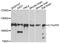 FA Core Complex Associated Protein 100 antibody, A8591, ABclonal Technology, Western Blot image 