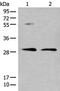 N-Acetyltransferase 8 Like antibody, PA5-68424, Invitrogen Antibodies, Western Blot image 
