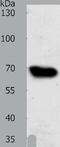 ATP Binding Cassette Subfamily G Member 1 antibody, TA322701, Origene, Western Blot image 