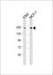 5'-3' Exoribonuclease 1 antibody, M02855, Boster Biological Technology, Western Blot image 