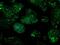 Isocitrate Dehydrogenase (NAD(+)) 3 Alpha antibody, MA5-25007, Invitrogen Antibodies, Immunocytochemistry image 