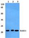 RAB31, Member RAS Oncogene Family antibody, A05883-1, Boster Biological Technology, Western Blot image 